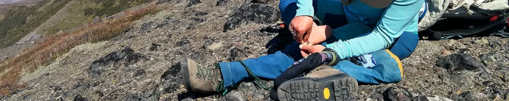 Blister treatment for backpackers, Wrangell-St. Elias National Park